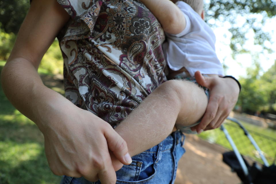 Angela Martínez holds her son Uriel as they walk in a park in Granada, south of Spain, Saturday, Aug. 31, 2019. Uriel's body is covered in hair due to taking a hair-growing medicine containing minoxidil, wrongly labeled as omeprazole. Parents of babies in Spain developing unusual levels of body hair say they are readying a joint lawsuit against the pharmaceutical company that mislabeled an anti-hair-loss drug as a stomach stabilizer. (AP Photo/Sergio Ruiz)