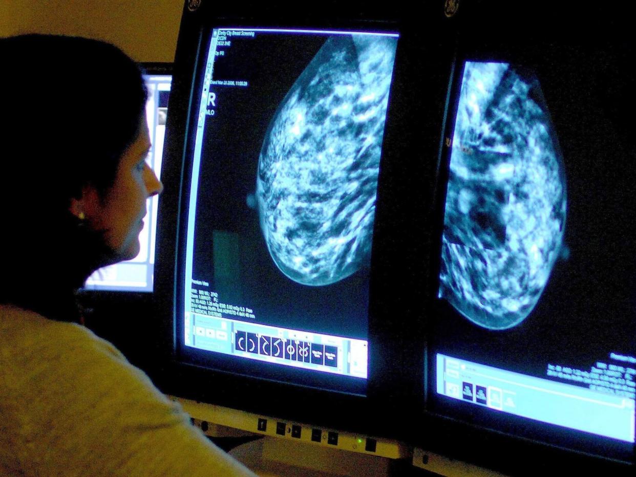 A consultant analyzing a mammogram: PA