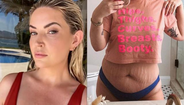 Canadian influencer Sarah Nicole Landry shows off stretch marks