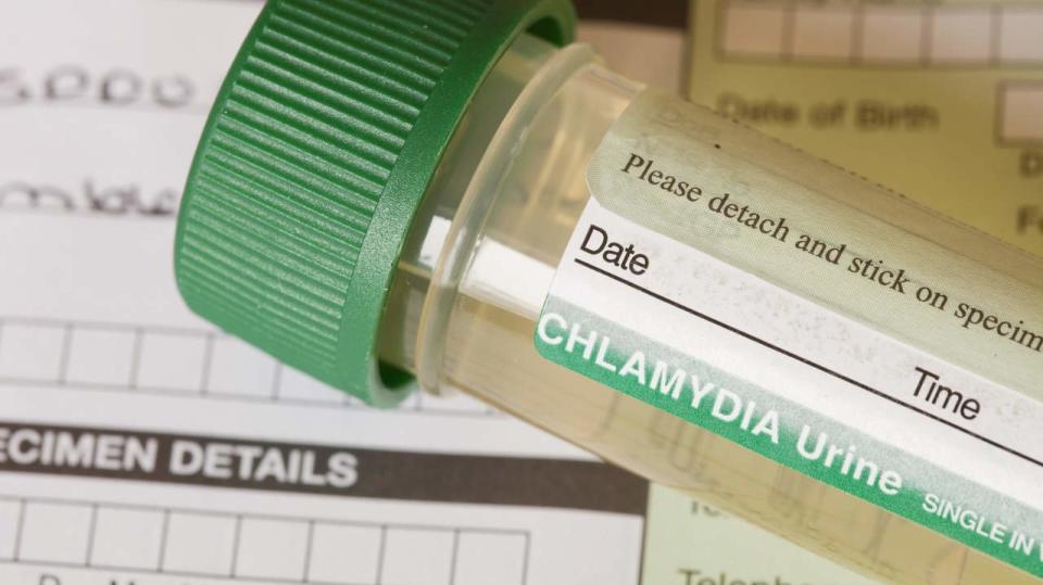 Chlamydia is a sexually transmitted disease caused by <i>Chlamydia trachomatis</i> bacteria. Chlamydia bacterial infections are more common among sexually active teens and young adults.