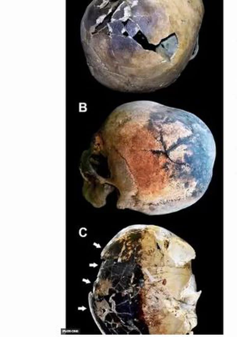 Los cráneos de las víctimas explotaron