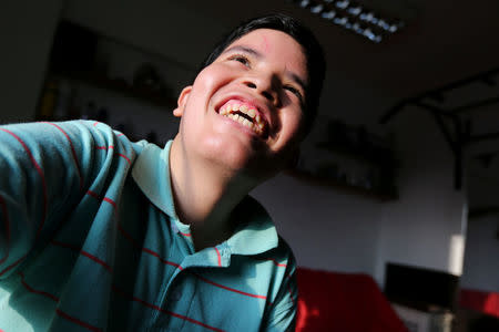 Anthony, 17 year old boy who has tuberous sclerosis and Lennox-Gastaut syndrome is seen at his house in Lima, Peru, February 23, 2017. REUTERS/Guadalupe Pardo