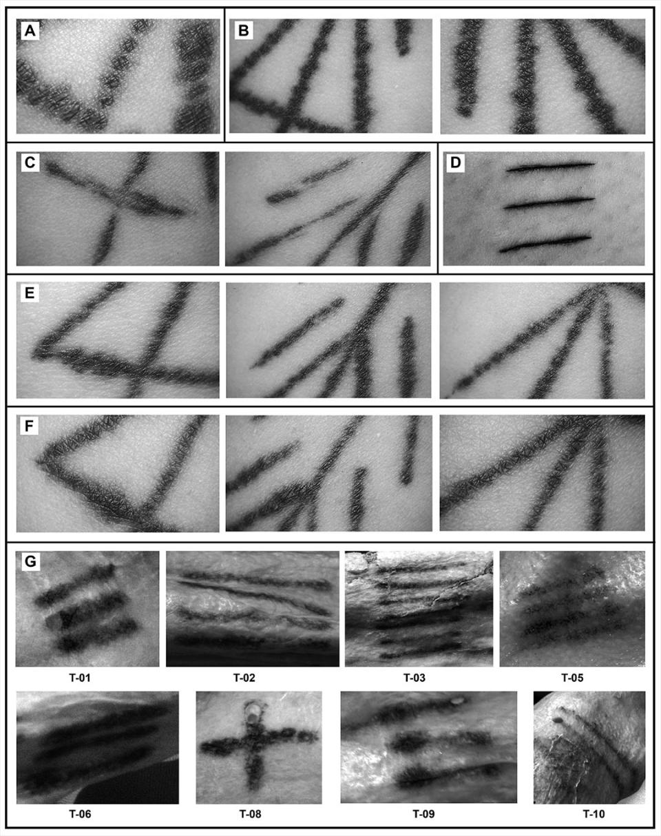 A comparison of the modern tattoos (A to F) and Ötzi's tattoos (G) indicated that the Iceman's were made with the 