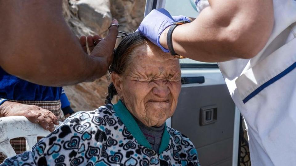 Woman getting a head injury taken care of, 8 September