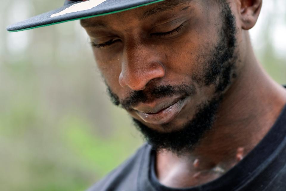 Miichael Corey Jenkins stands outside Taylor Hill Church in Braxton, Mississippi. The police shooting of Jenkins, who sustained critical injuries after he says a deputy put a gun in his mouth and fired, led the Justice Department to open a civil rights investigation into the Rankin County Sheriff's Office.