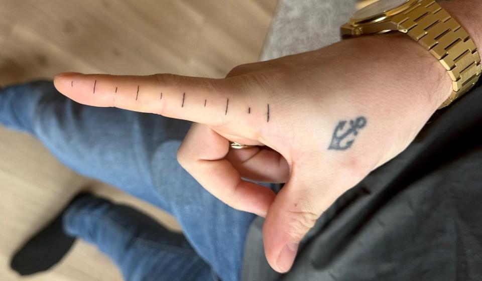 Steffen Karlsen decided to tattoo a ruler on his finger. Julie Strømsnes / SWNS
