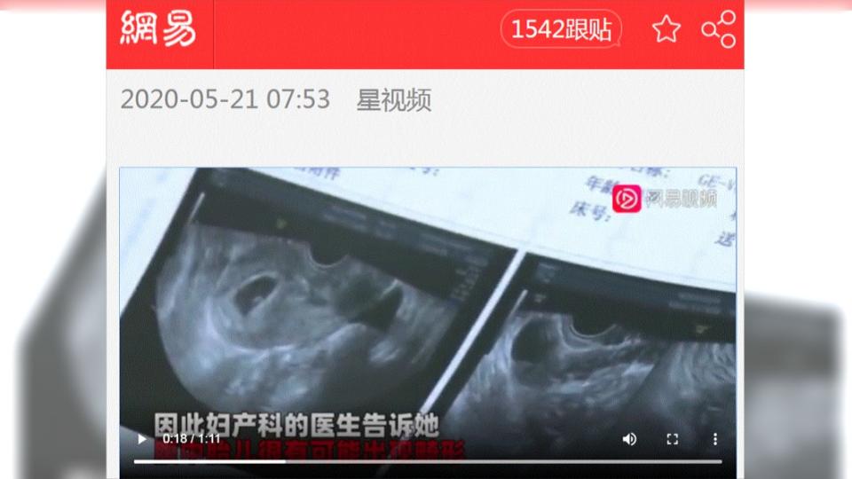 (圖／翻攝自網易新聞)