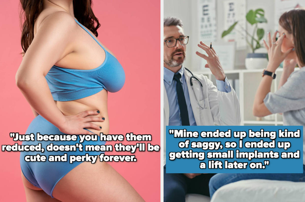 Women Who Have Had A Breast Reduction Are Sharing The Surprising