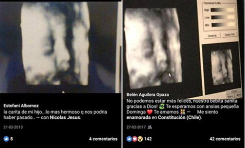 A mother found another woman's ultrasound posted online that looked exactly the same as hers from two years ago. Source: Belen Aguilera/The Creative Educator, Facebook 