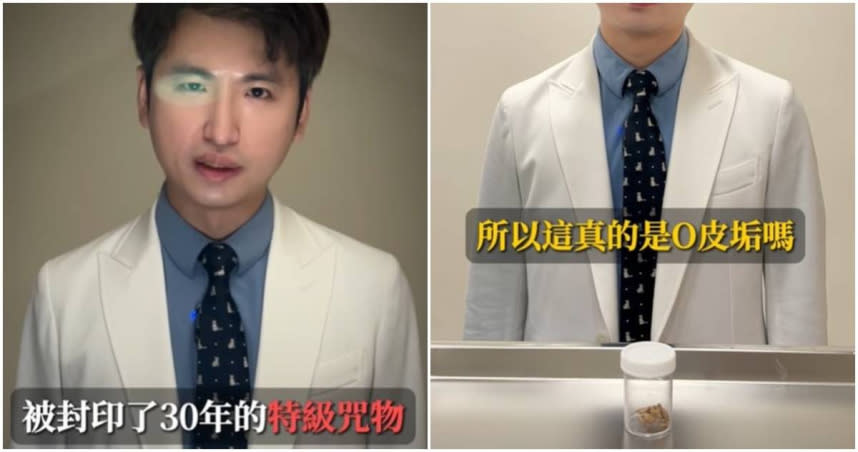 泌尿科醫師秀30歲男子的「陳年包皮垢」。（圖／翻攝dr_zhaoan IG）