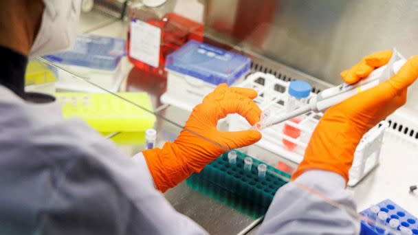 PHOTO: An employee of the vaccine company Bavarian Nordic works in a laboratory of the company in Martinsried near Munich, Germany, May 24, 2022. (Lukas Barth/Reuters, FILE)