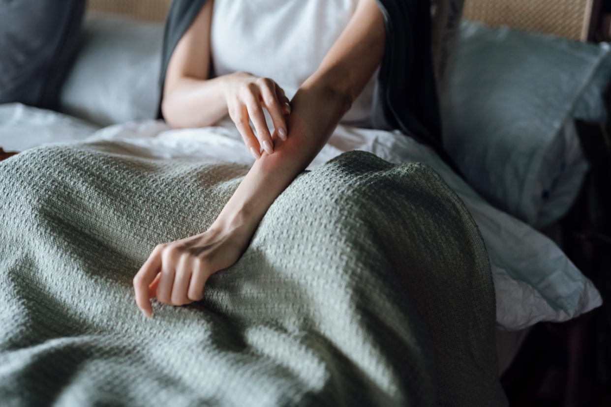 Divers nuisibles peuvent être à l'origine de piqûres et d'allergies (crédit : getty image)