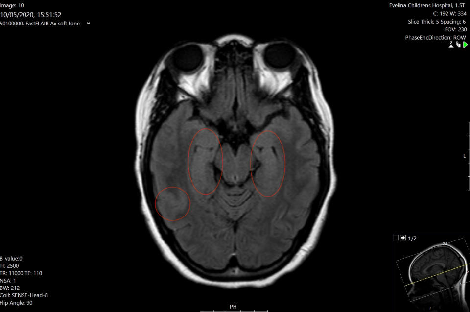 MRI scan (Evelina Children's Hospital, London)