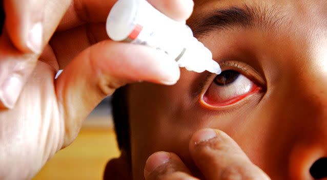 Doctors said the man was smart to rinse his eyes with water straight after. Photo: Getty