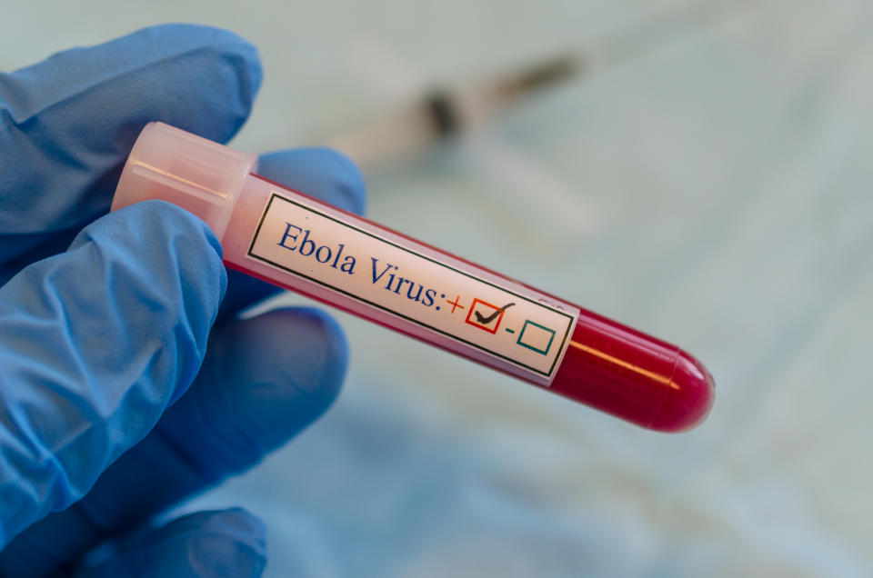 A blood collection tube label as fake ebola virus positive