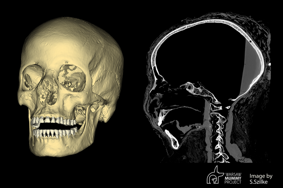 The mysterious pregnant mummy skull (WMP, S.Szilke)