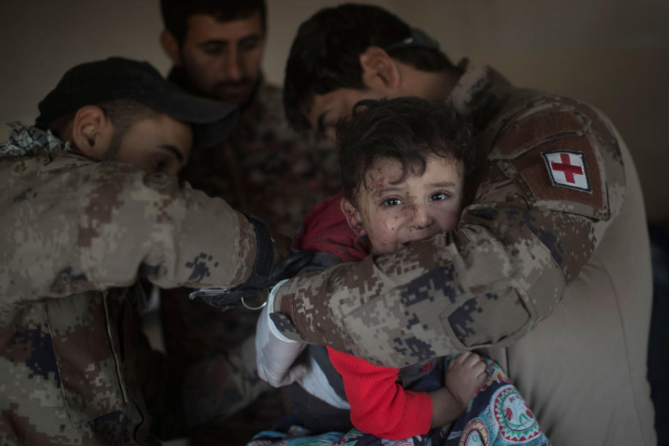 Injured boy near Mosul