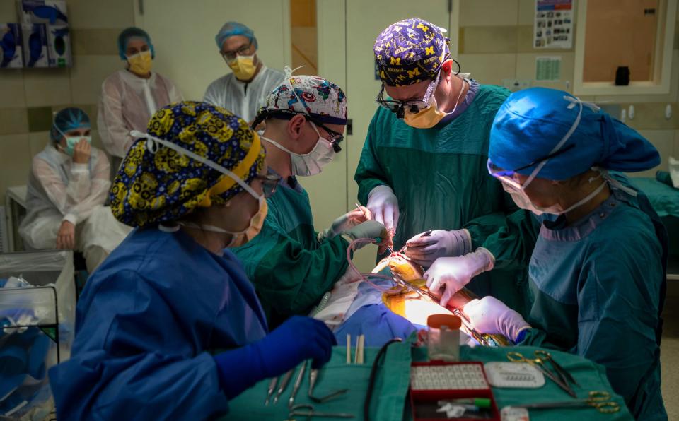 Hannes Prescher, a craniofacial surgery fellow, left, Christian Vercler, plastic surgeon, center, and an integrated plastic surgery resident, Emily Graham, perform a facial reconstruction surgery on Amedy Dewey, 23, inside the University of Michigan C.S. Mott Children's Hospital in Ann Arbor on Monday, July 24, 2023.