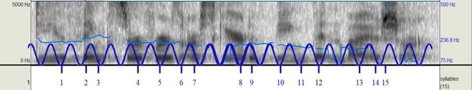 This acoustic spectrogram of the utterance ‘Do you think surfers are scared of being bitten by a shark?’ has an overlaid oscillatory function (blue wave). This shows that midpoints of most syllables (numbered hash marks) occur at or near the wave troughs, regardless of syllable length. The hash marks were generated with a Praat script written by deJong and Wempe. Julie Boland, <a href="http://creativecommons.org/licenses/by-nd/4.0/" rel="nofollow noopener" target="_blank" data-ylk="slk:CC BY-ND;elm:context_link;itc:0;sec:content-canvas" class="link ">CC BY-ND</a>