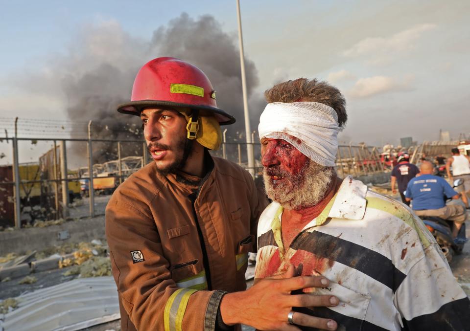 EDITORS NOTE: Graphic content / A wounded man is helped by a fireman near the scene of an explosion in Beirut on August 4, 2020. - Two huge explosion rocked the Lebanese capital Beirut, wounding dozens of people, shaking buildings and sending huge plumes of smoke billowing into the sky. Lebanese media carried images of people trapped under rubble, some bloodied, after the massive explosions, the cause of which was not immediately known. (Photo by ANWAR AMRO / AFP) (Photo by ANWAR AMRO/AFP via Getty Images)