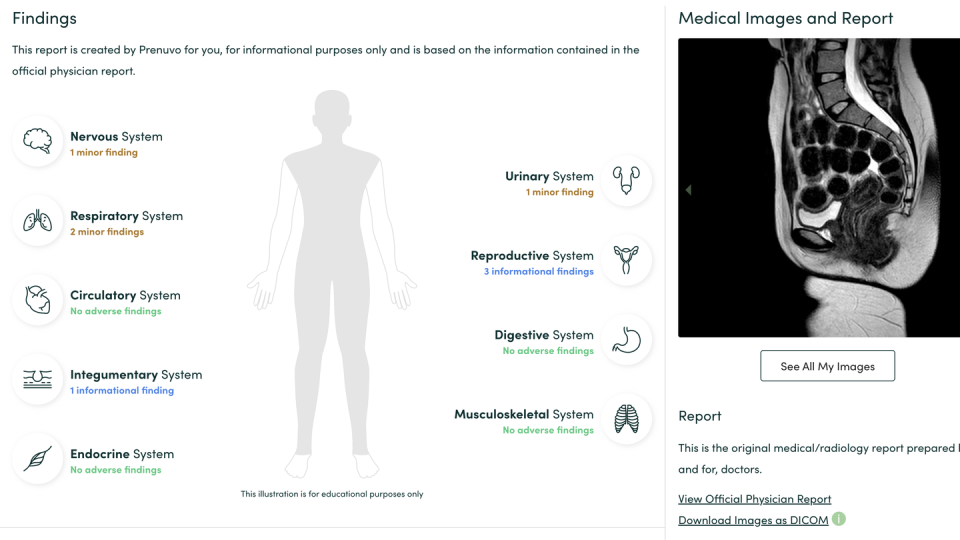 prenuvo results portal