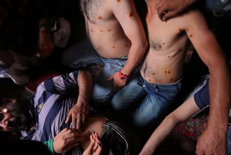 FILE PHOTO: Men with pellet injuries are treated inside a house in Srinagar