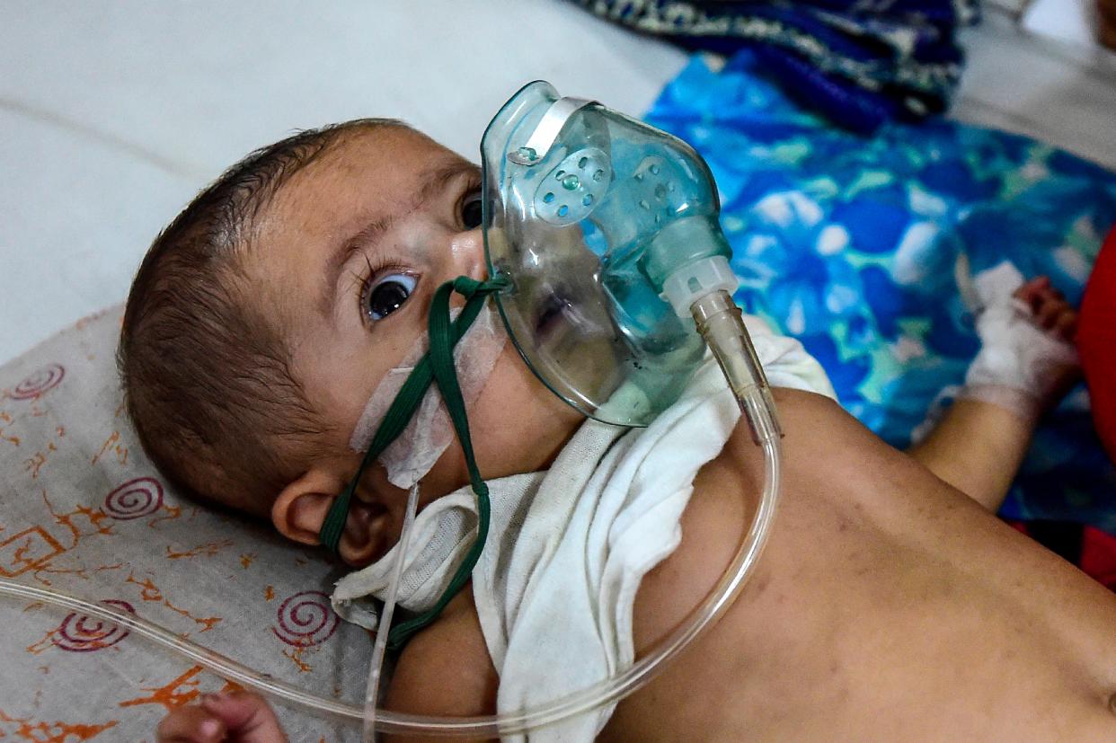 File image: A baby  suffering from respiratory disease receives treatment in Dhaka (AFP via Getty Images)