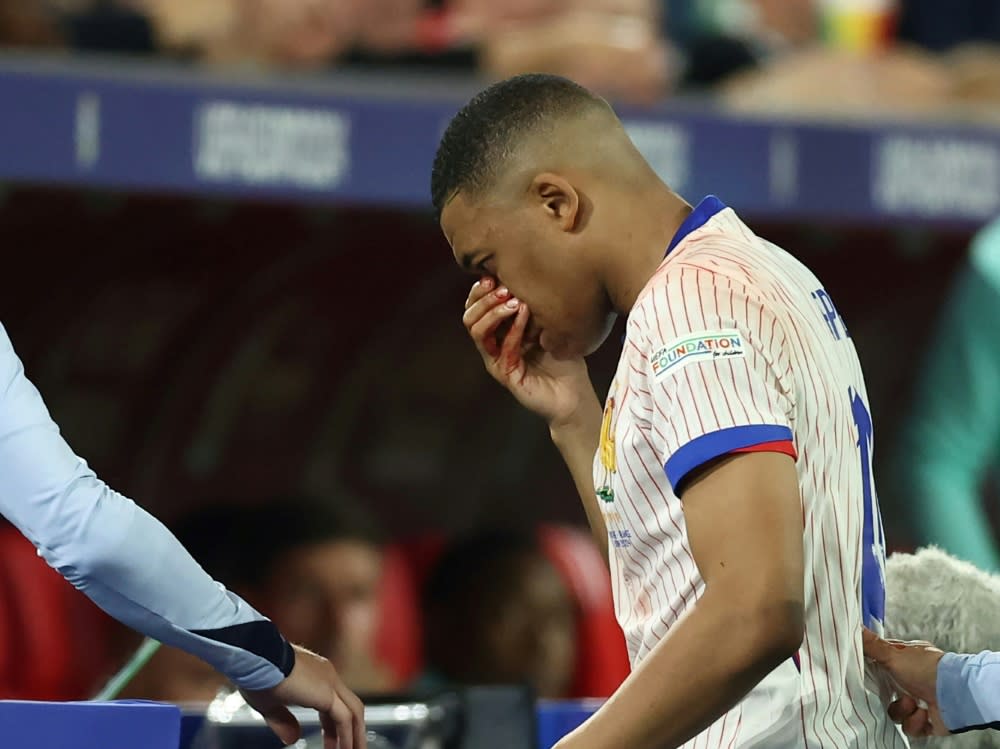 Mit blutender Nase verließ Kylian Mbappe den Platz (FRANCK FIFE)