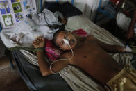 <p>An injured Rohingya boy Mohammad Junayed, 15, receives treatment for a bullet wound, at Chittagong Medical College Hospital in Chittagong, Friday, Sept. 8, 2017. (Photo: A.M. Ahad/AP) </p>