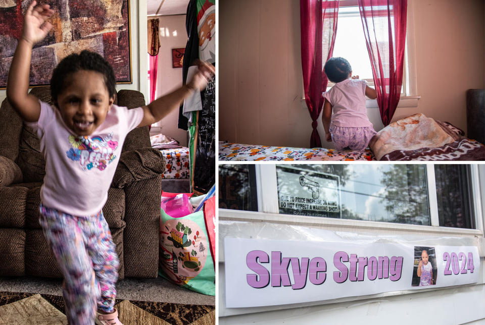 Skye McBride remains active as she regains function in her leg (Cydni Elledge for NBC News)