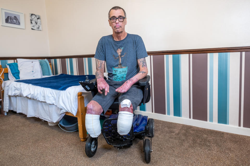 Mark day,61 at his home in Colchester Essex having recently  left hospital. See SWNS Cambridge copy SWCAdog:A grieving woman has told how a 