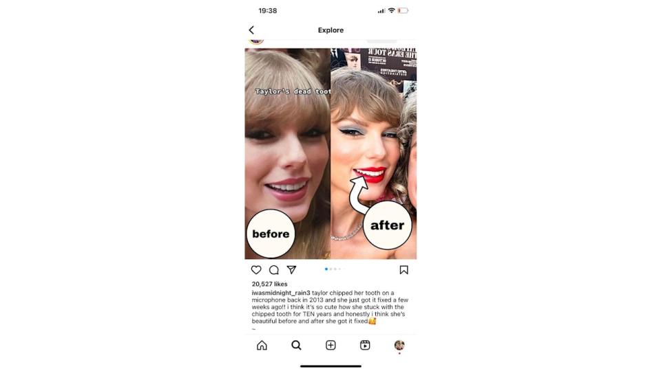 One fan posted before and after pics of Taylor's teeth