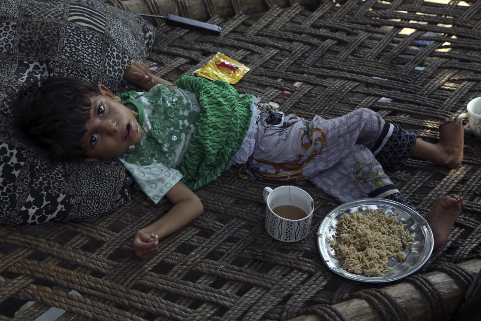 A displaced sick boy takes food and refuge after fleeing his flood-hit homes, in Charsadda, Pakistan, Tuesday, Aug. 30, 2022. Disaster officials say nearly a half million people in Pakistan are crowded into camps after losing their homes in widespread flooding caused by unprecedented monsoon rains in recent weeks. (AP Photo/Mohammad Sajjad)
