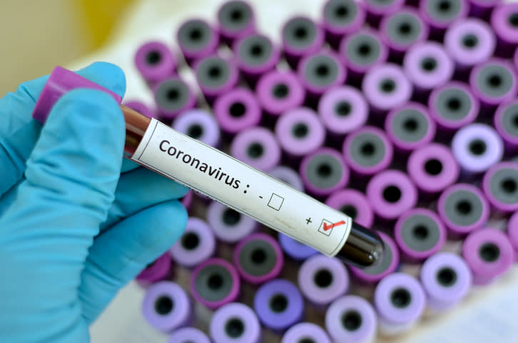 Nuevo coronavirus: casos hasta la fecha