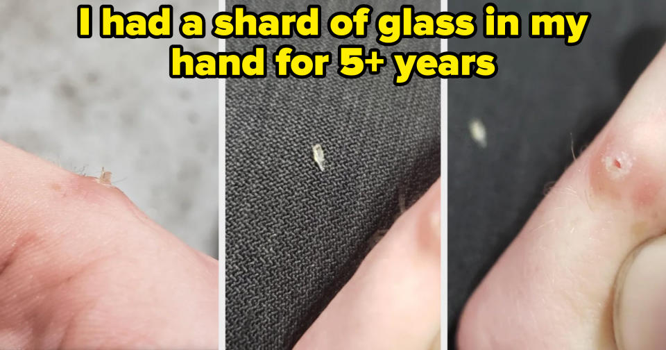 tiny shard of glass in someone's hand then on fabric behind it