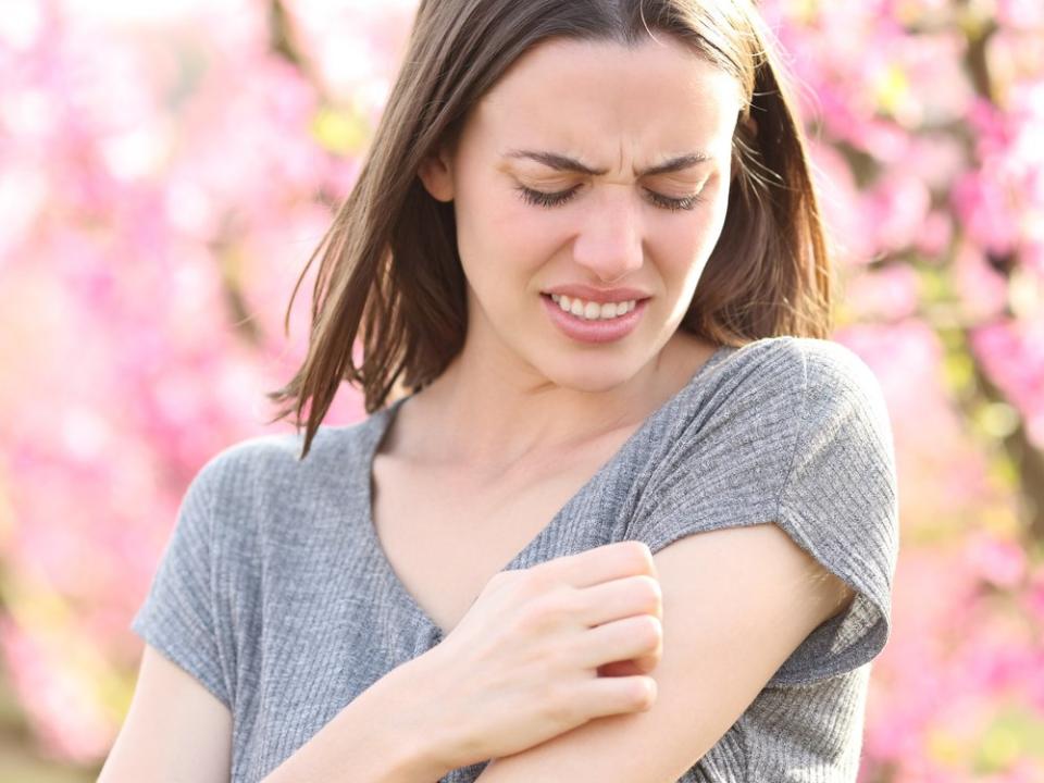 Sowohl Wespen- als auch Bienenstich können starke Reaktionen hervorrufen. (Bild: Pheelings media/Shutterstock.com)