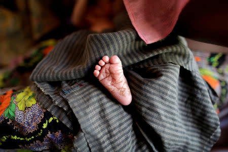 A foot of the newborn Rohingya baby is pictured at a medical center in Kutupalong refugees camp in Cox's Bazar, Bangladesh, October 15, 2017. REUTERS/Zohra Bensemra