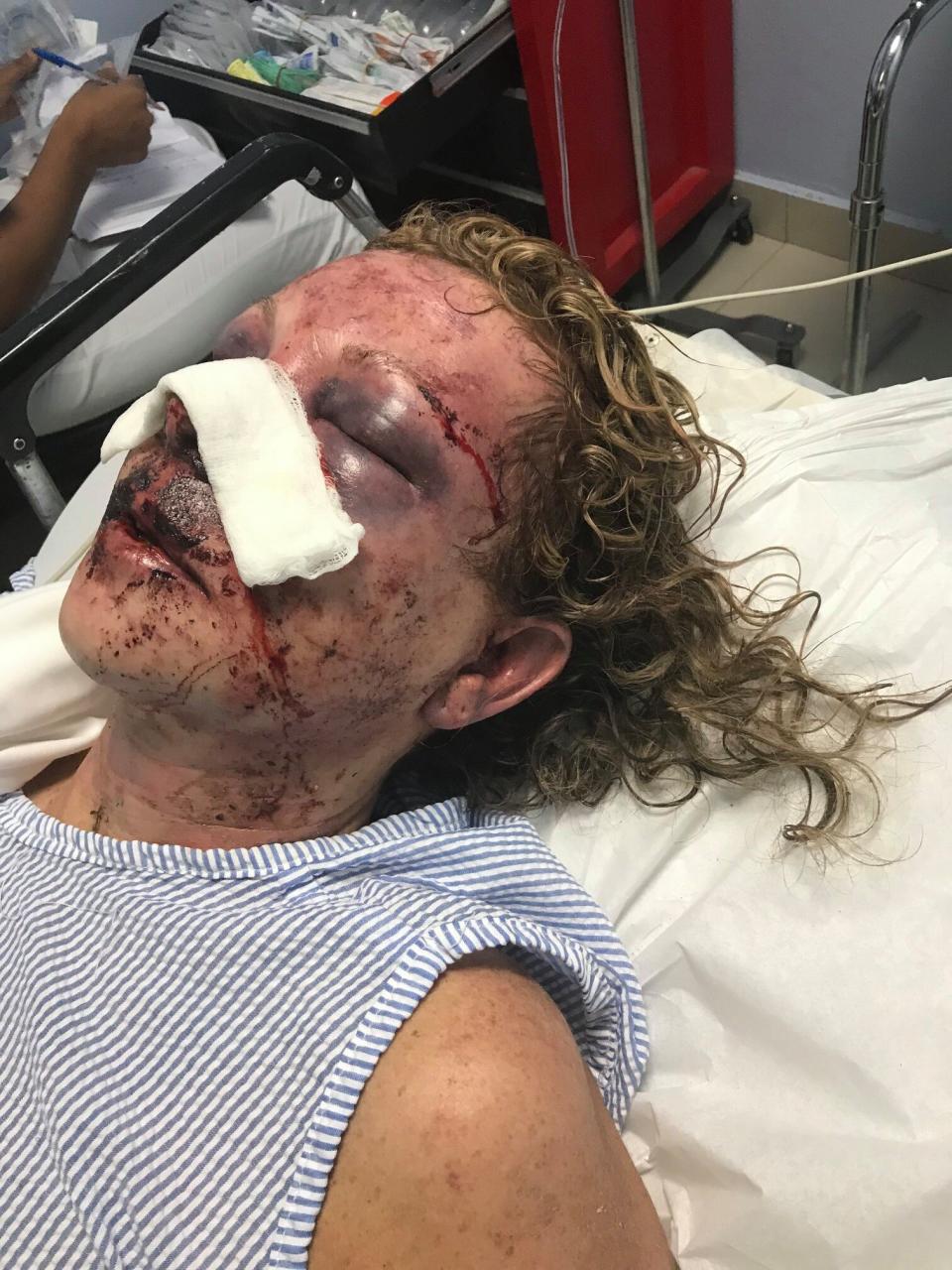 The woman is still suffering from her injuries, four months after the attack. Source: Facebook/Tammy Lawrence-Daley 