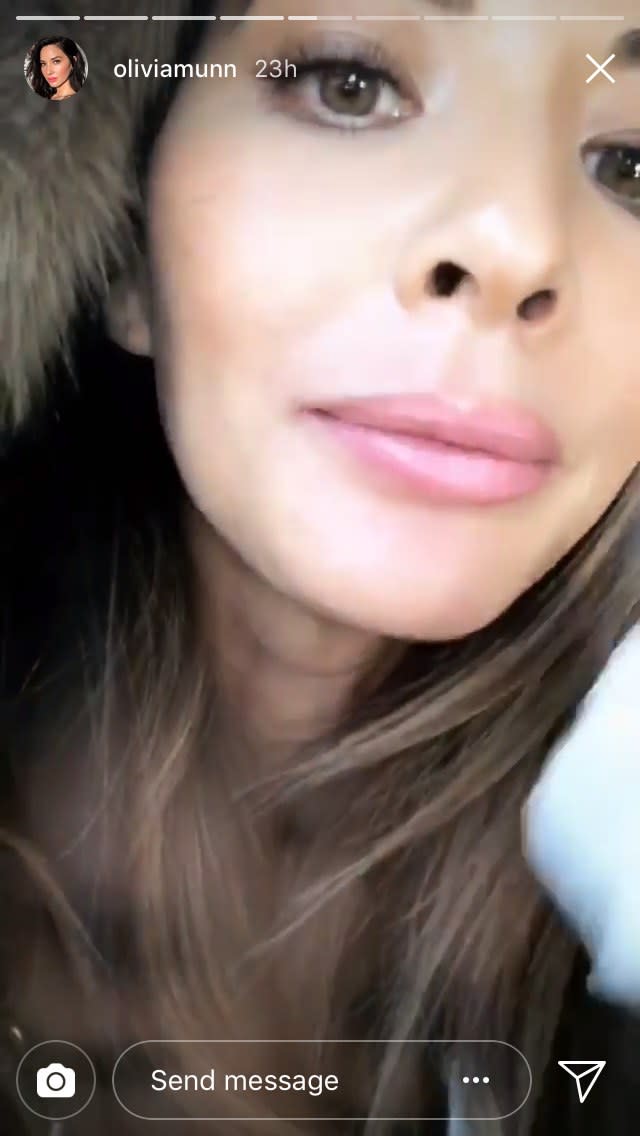 Olivia Munn swiped off her lipstick on her Instagram Story to shoot down plastic surgery rumors and reveal that her plump lips were the result of makeup.
