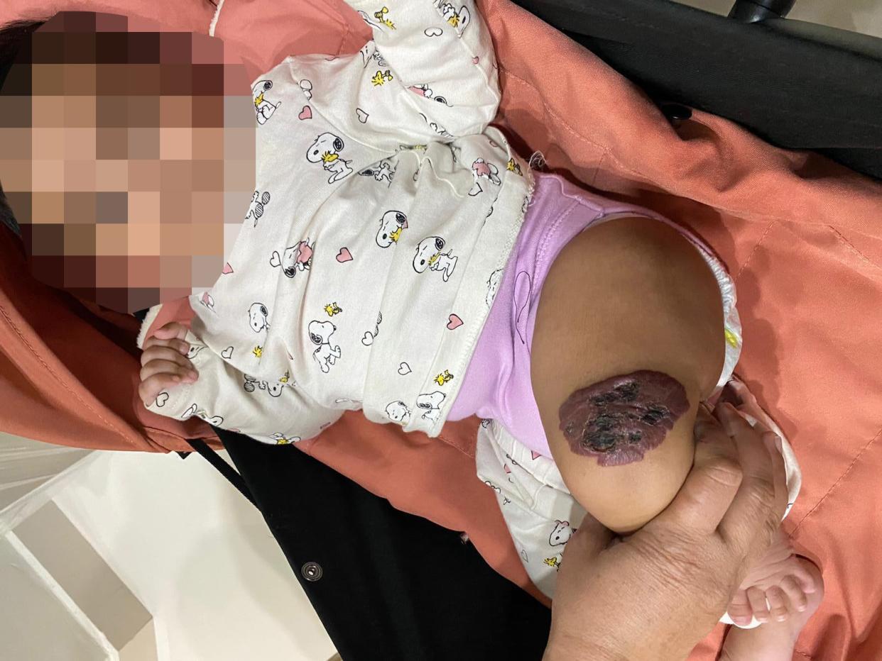 The parents of Aleha, aged four months, waited more than eight hours before being able to take their daughter to hospital for urgent treatment  (Sohaib Wasim)