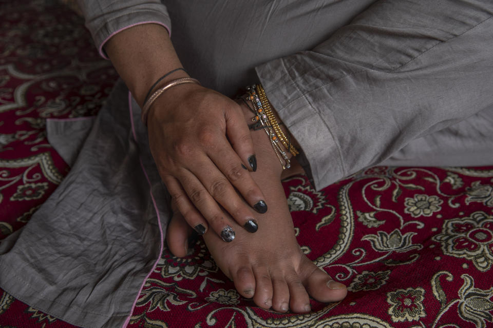 Transgender Kashmiri Khushi Mir rests in her rented room on the outskirts of Srinagar, Indian controlled Kashmir, Friday, June 4, 2021. Until the pandemic, singing and dancing at weddings used to earn Mir enough income to take care of her family. Unable to pay for her rented accommodation, the 19-year-old took a job as a construction worker for 15 days that paid $9.60 a day. Mir has set up a charity, along with four friends, to distribute food kits to members of the transgender community. (AP Photo/ Dar Yasin)