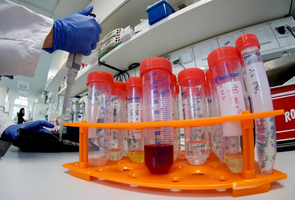 A lab assistant working on samples as part of research into the coronavirus at the institute for virology at Berlin's Charite hospital: AP