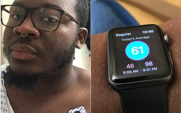 How an Apple Watch notification saved a man's life  - Twitter / @_jamestgreen