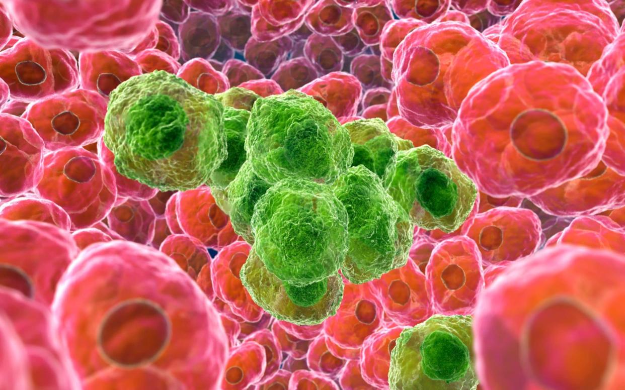 Artists impression of cancer cells - Science Photo Library