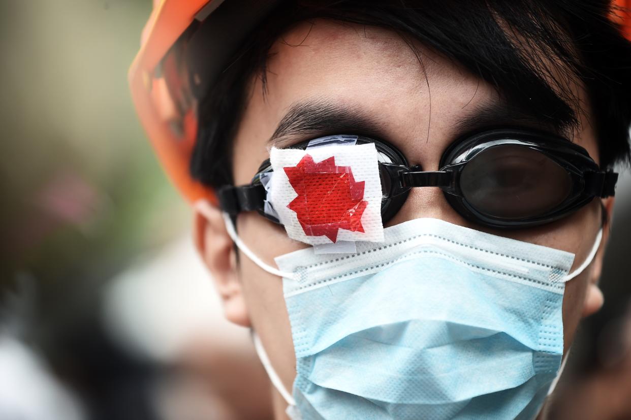 Das blutende Auge hat sich in der Ikonographie der Hongkonger Protestbewegung etabliert (Bild: Lillian Suwanrumpha/AFP)
