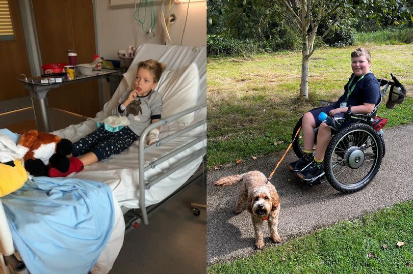 Rebecca Homewood's son Tom in hospital (left picture) vs Rebecca Homewood's son Tom in a wheelchair (right picture)