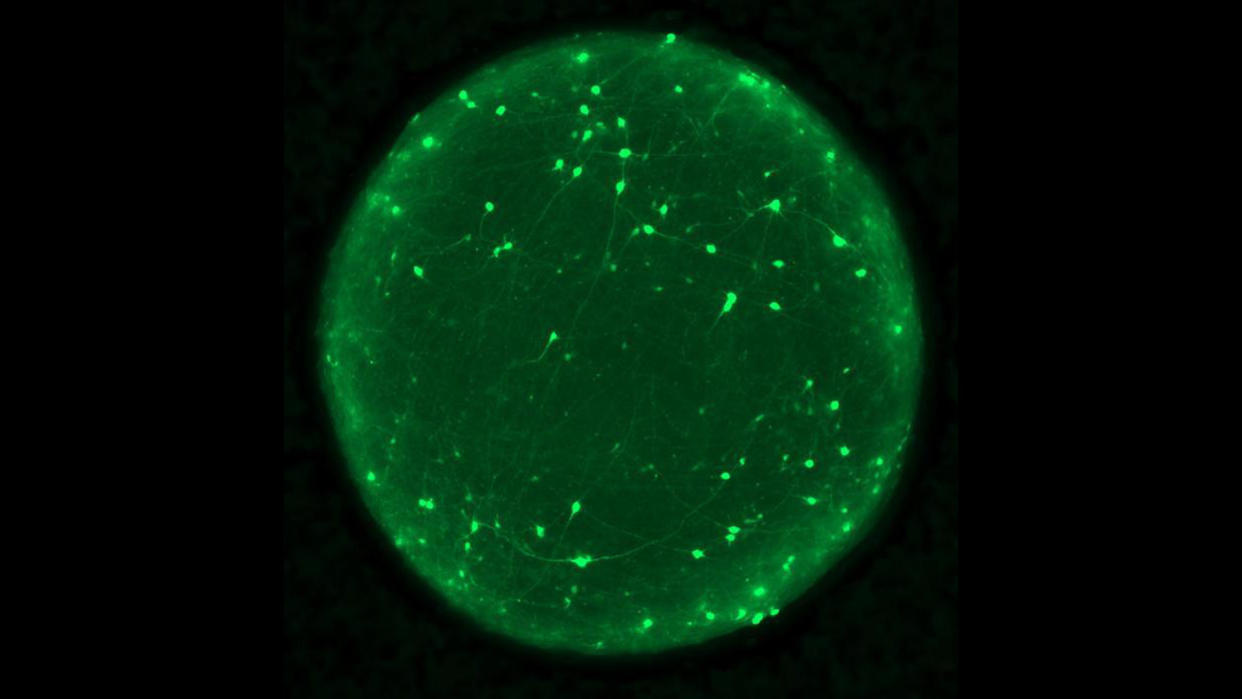  A glowing green sphere flecked with specks of brighter green against a black background. 