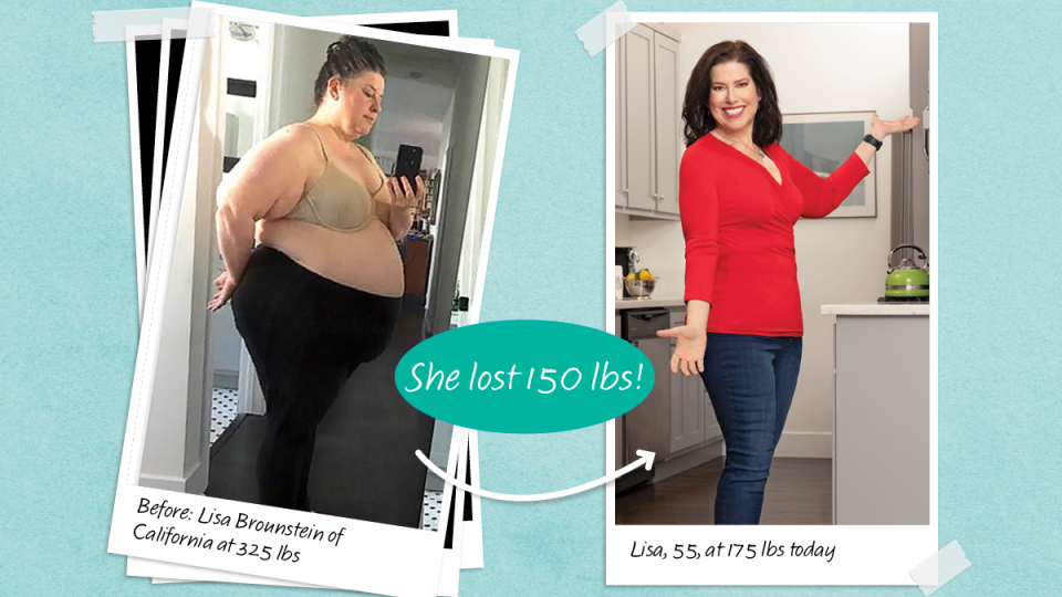 Before and after Lisa Brounstein who lost 150 lbs with no loose skin 