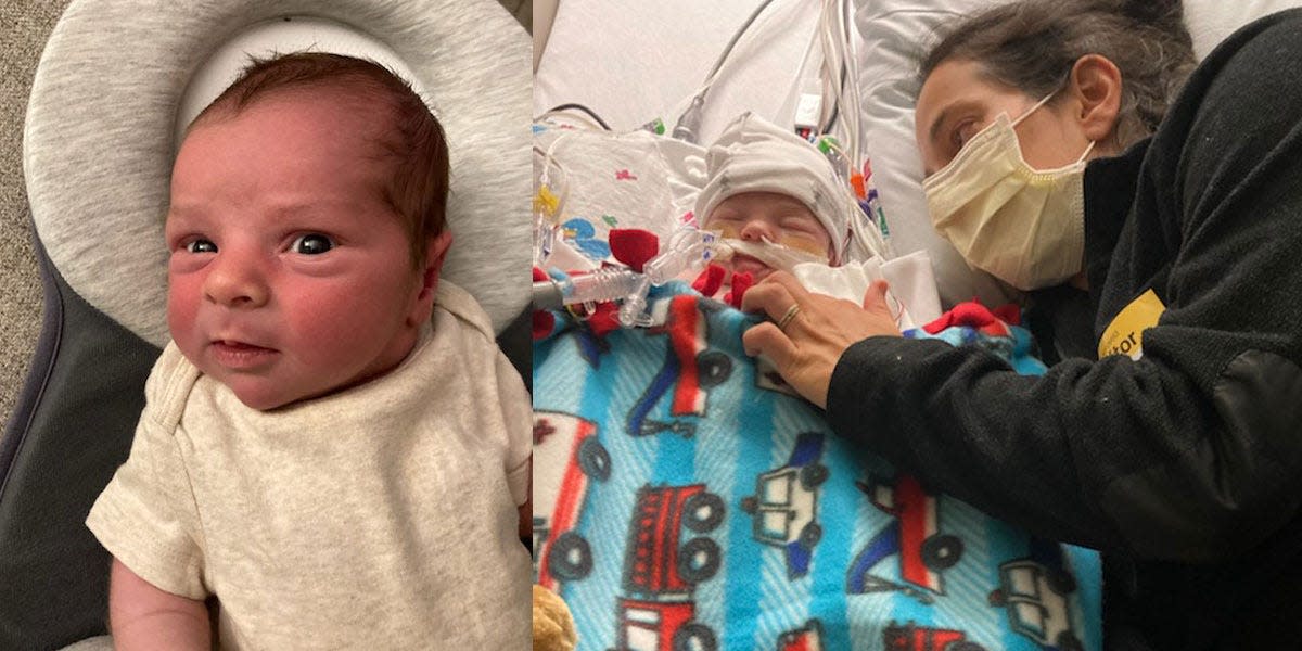 left: baby ronan smiling at home, 10 days old. right: baby ronan intubated in the hospital, with his mom at his side.