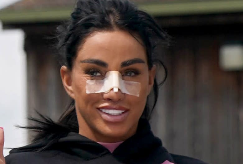 Katie Price with a bandage on her nose after having rhinoplasty surgery.
